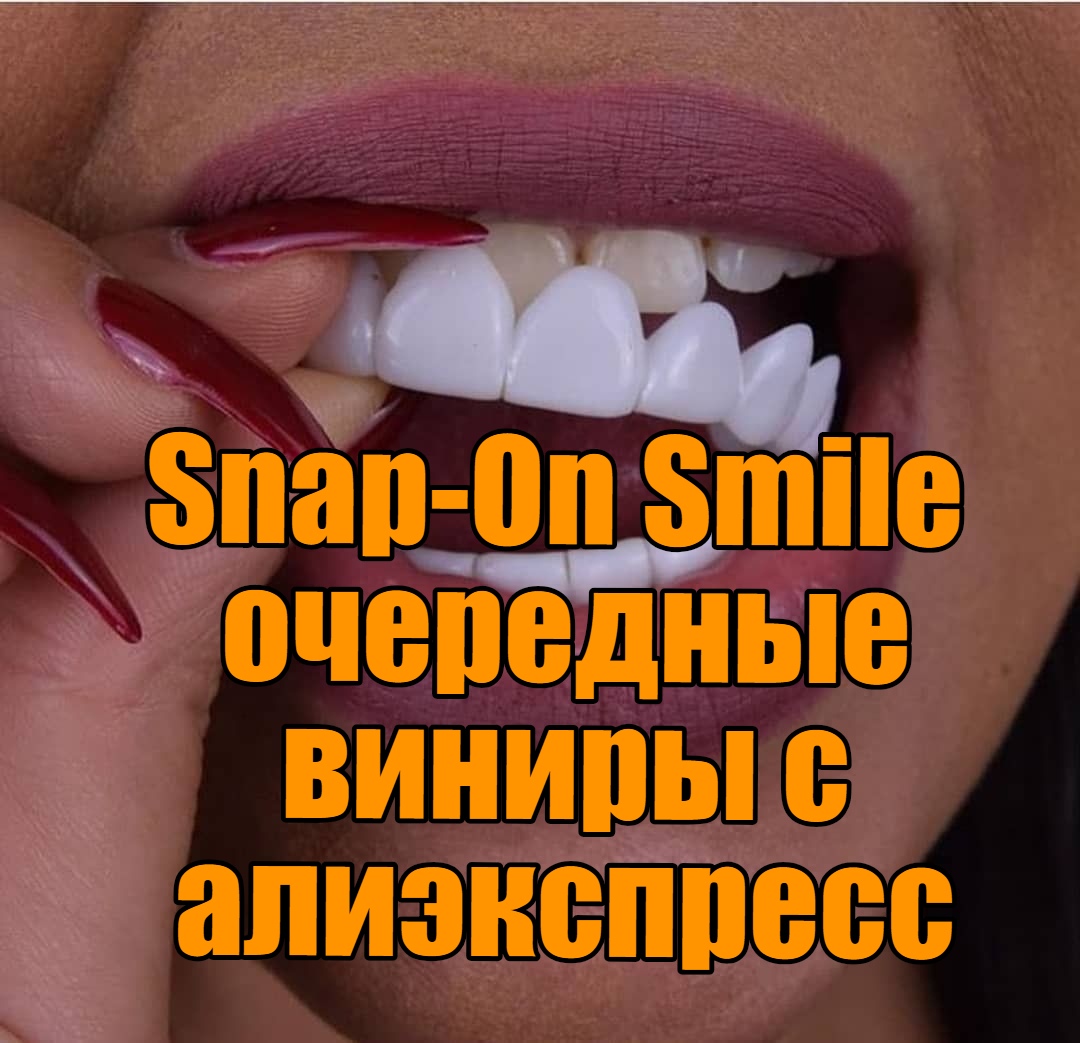 Не могу лизать у меня виниры песня. Виниры Snap on smile. Виниры на зубы АЛИЭКСПРЕСС.